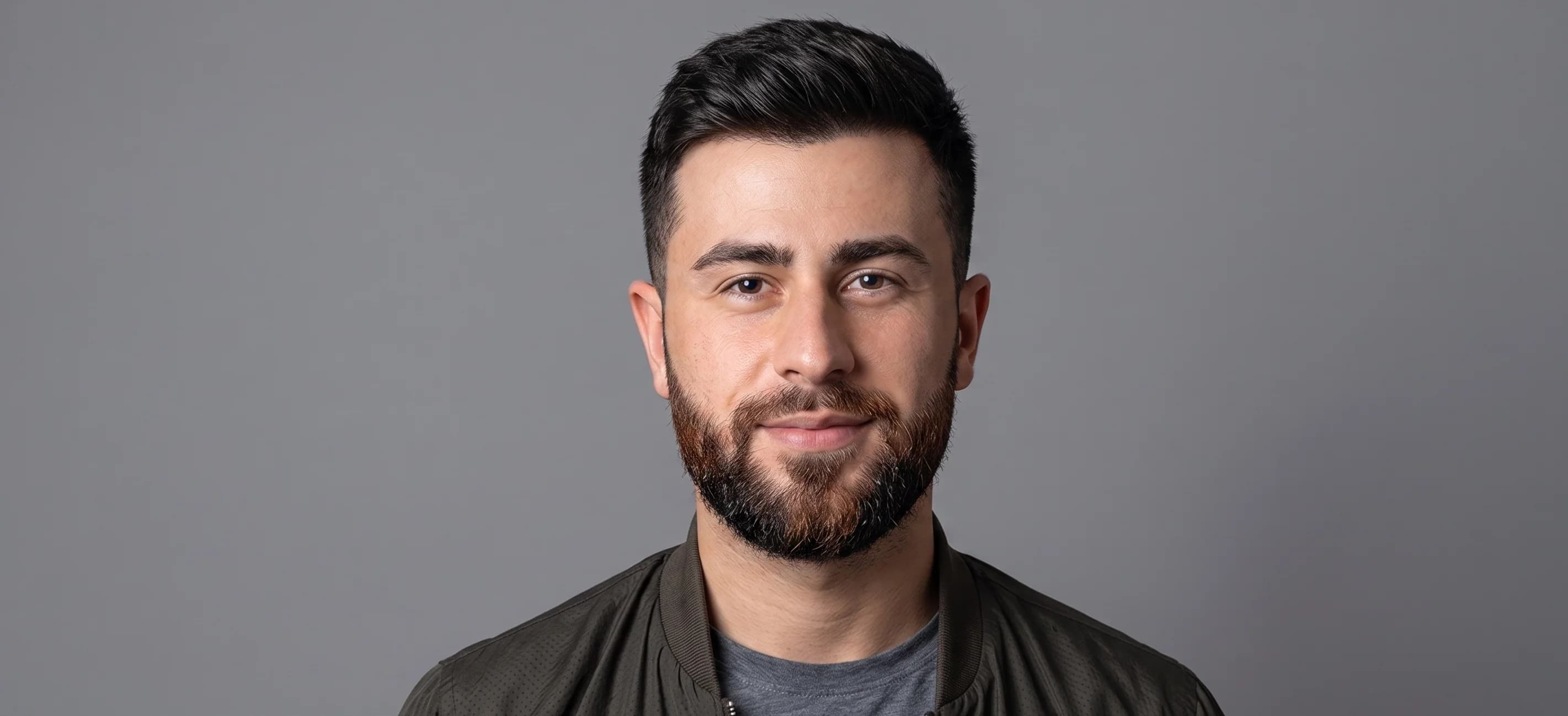 Smiling bearded patient standing prior to surgical facial restoration at Hair Skill Clinic