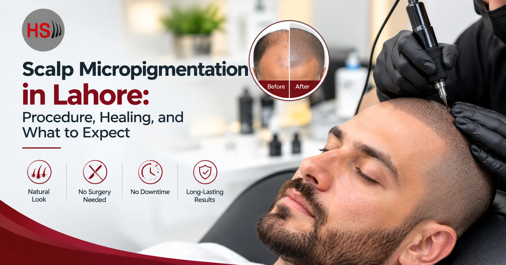 Scalp Micropigmentation in Lahore: Procedure, Healing, and What to Expect
