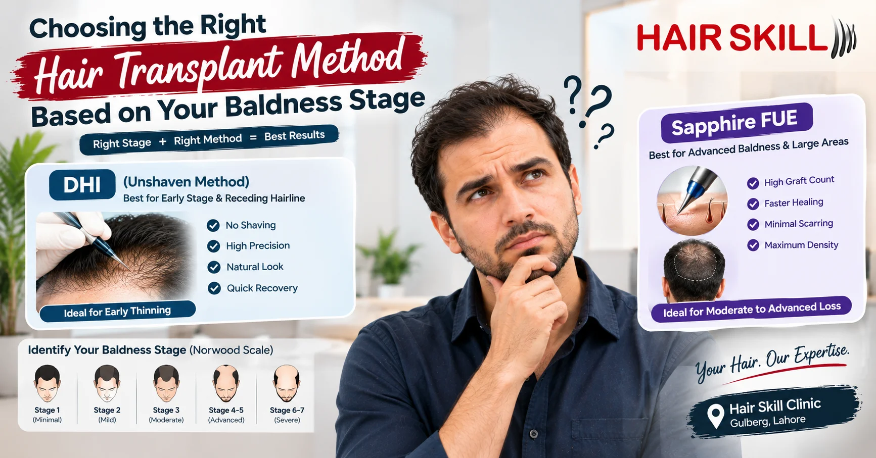 Choosing the Right Hair Transplant Method Based on Your Baldness Stage