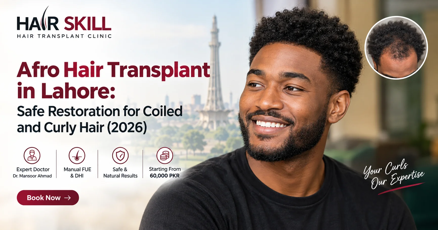 Afro Hair Transplant in Lahore: Safe Restoration for Coiled and Curly Hair (2026)