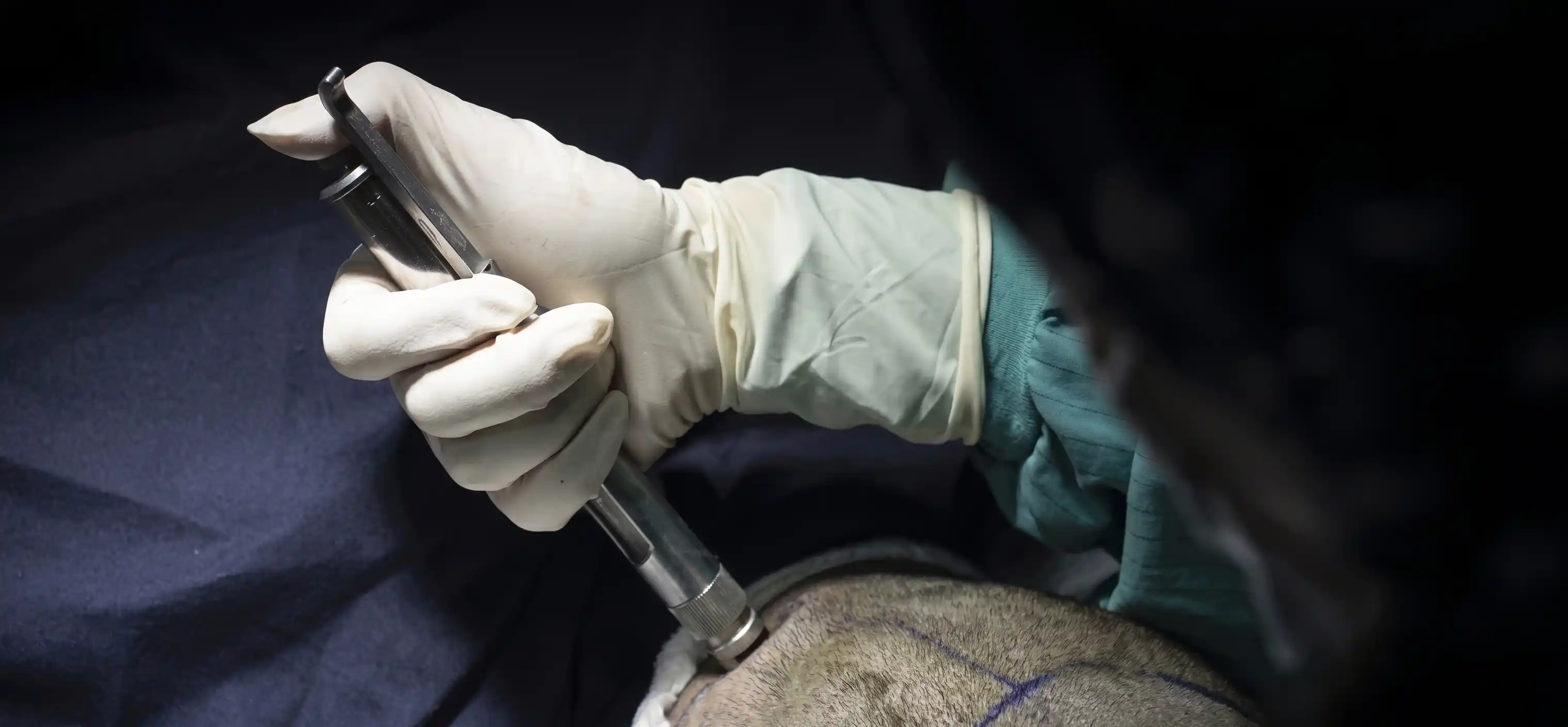 Surgeon holding advanced high pressure jet injection device used for Needle Free Anesthesia in Lahore