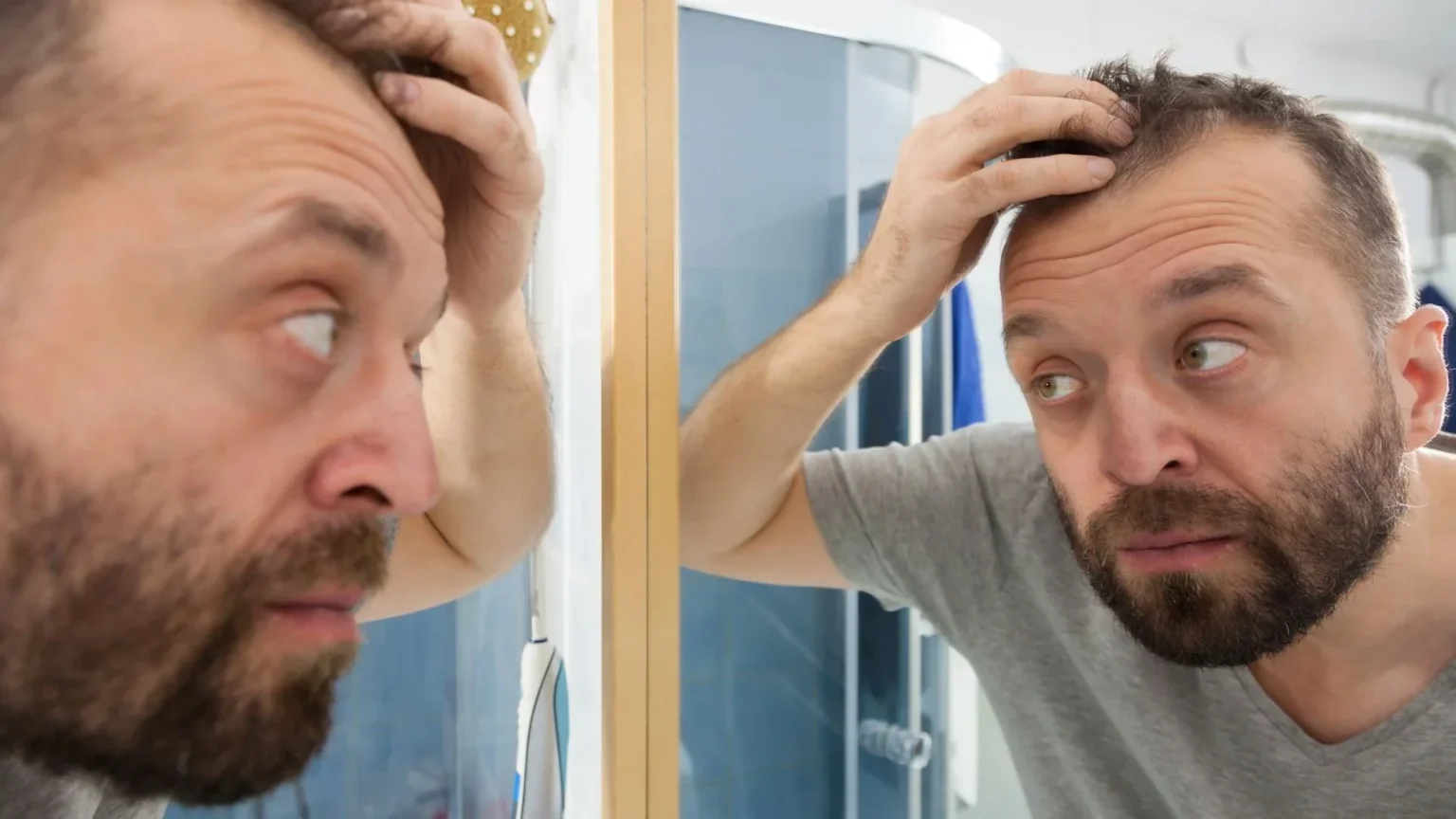 Gentleman checking native receding widows peak hairline inside mirror