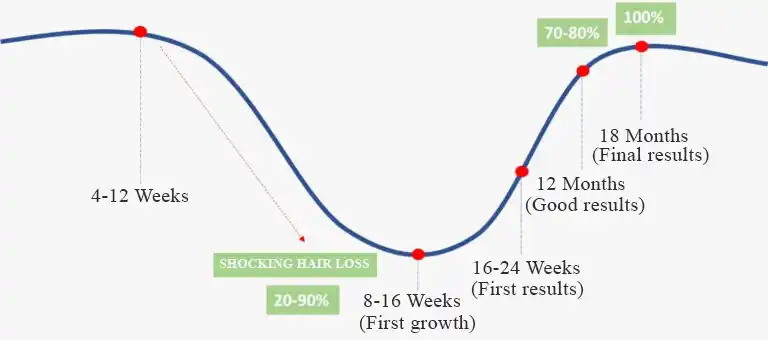 Clinical graph demonstrating follicular survival cycle shocking shedding phase and mature 18 month density