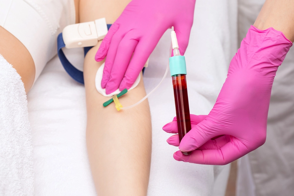 Clinical blood draw from patient arm into specialized biological centrifuge separation container