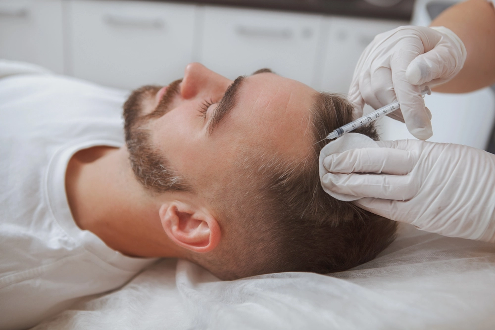 Surgeon administering concentrated platelet booster into patient crown and midscalp parting