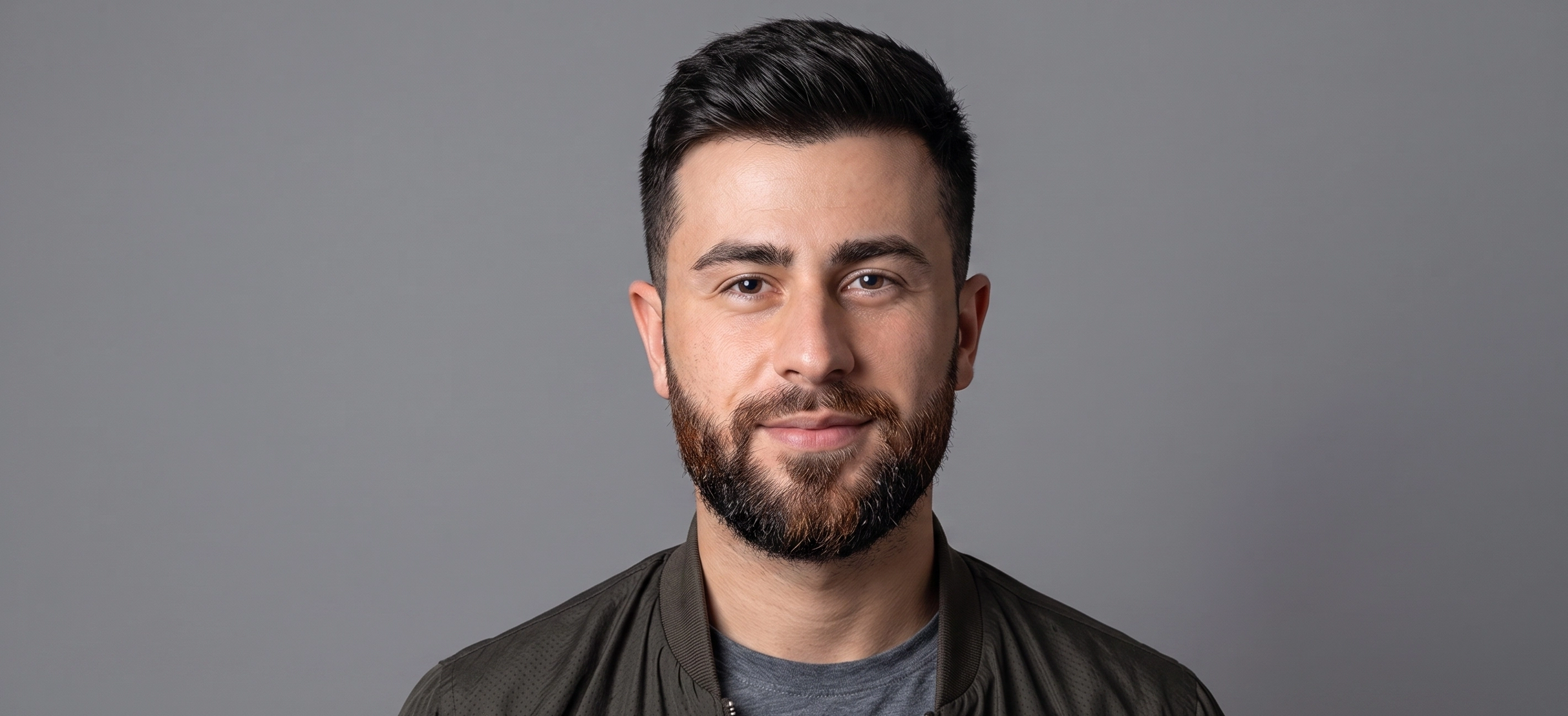 Smiling bearded patient standing prior to surgical facial restoration at Hair Skill Clinic