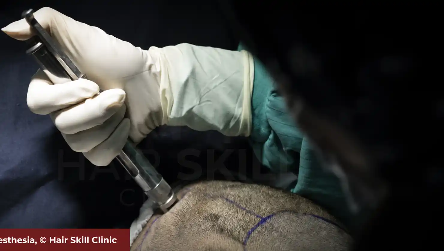 Needle-Free Anesthesia